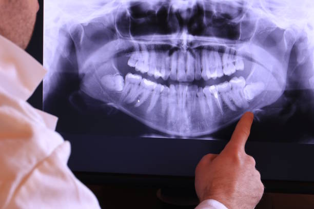 Best Broken or Cracked Tooth Emergency Dentist in Bing, OR