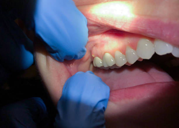 Best Pediatric Emergency Dentist in Bing, OR