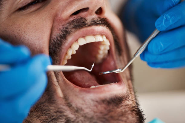 Best Pediatric Emergency Dentist in Bing, OR